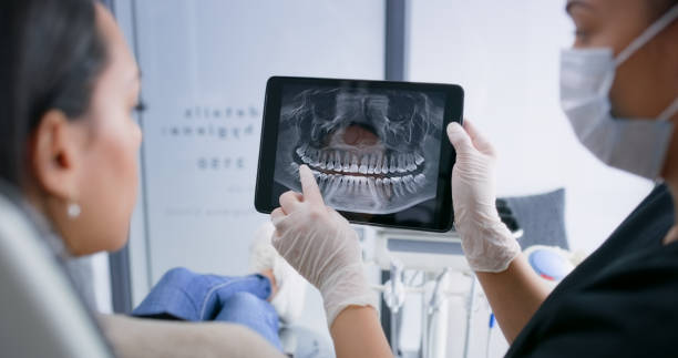 Licensed Wisdom Tooth Removal service in Anton, TX - Smile Center Dentistry